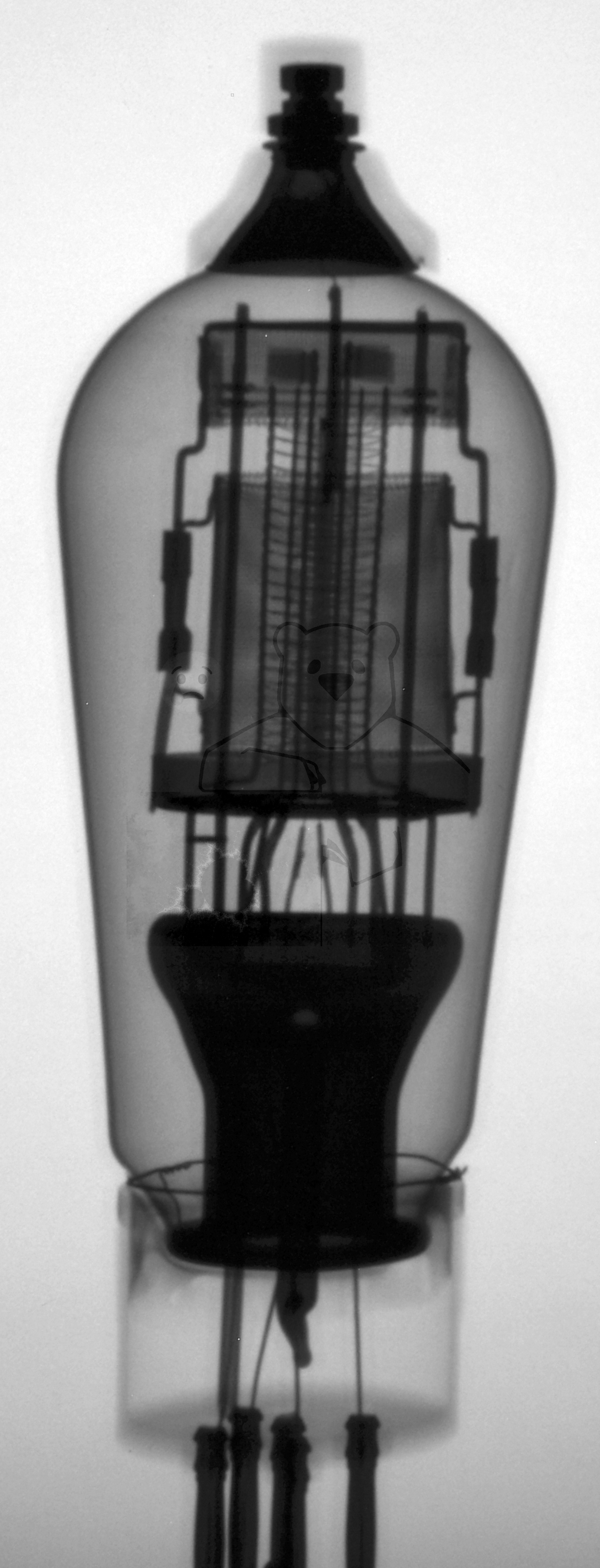 Röntgenbild AF2 Philips