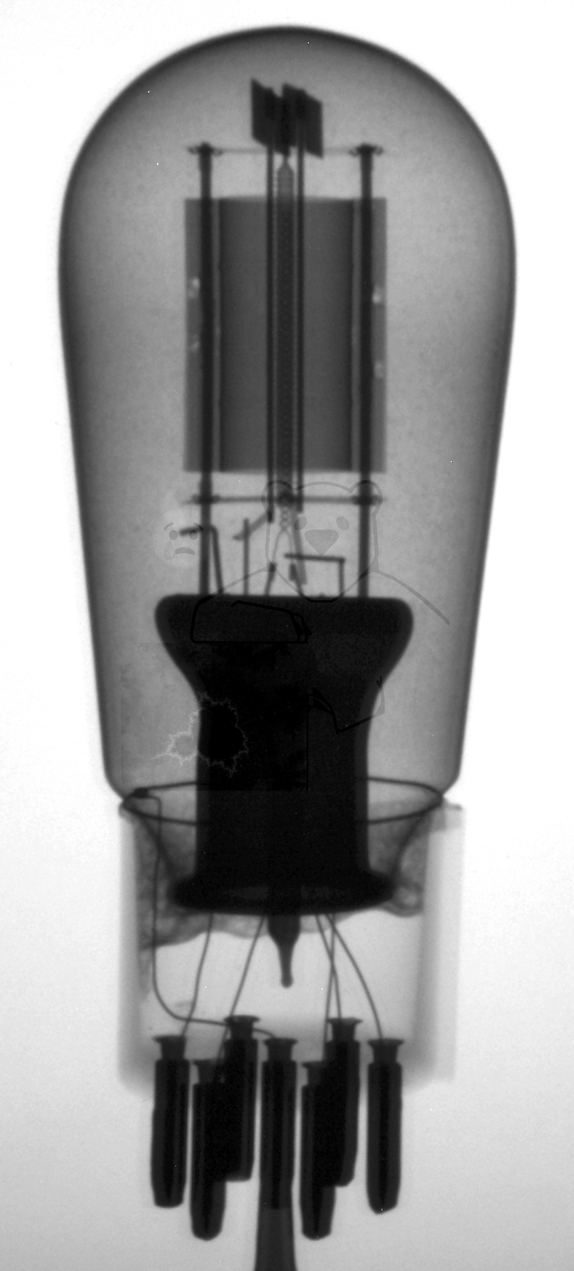 Röntgenbild Bi Siemens