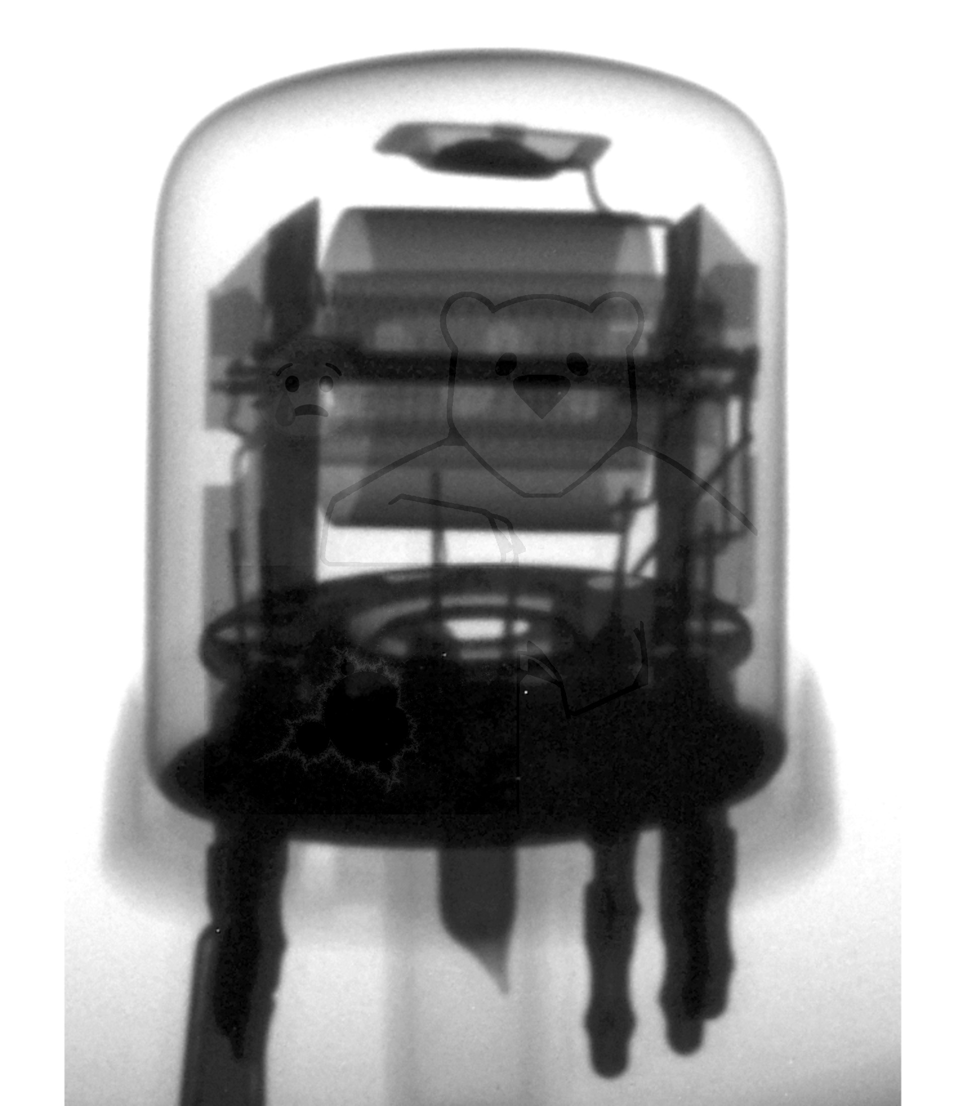 Röntgenbild EF13 RFT